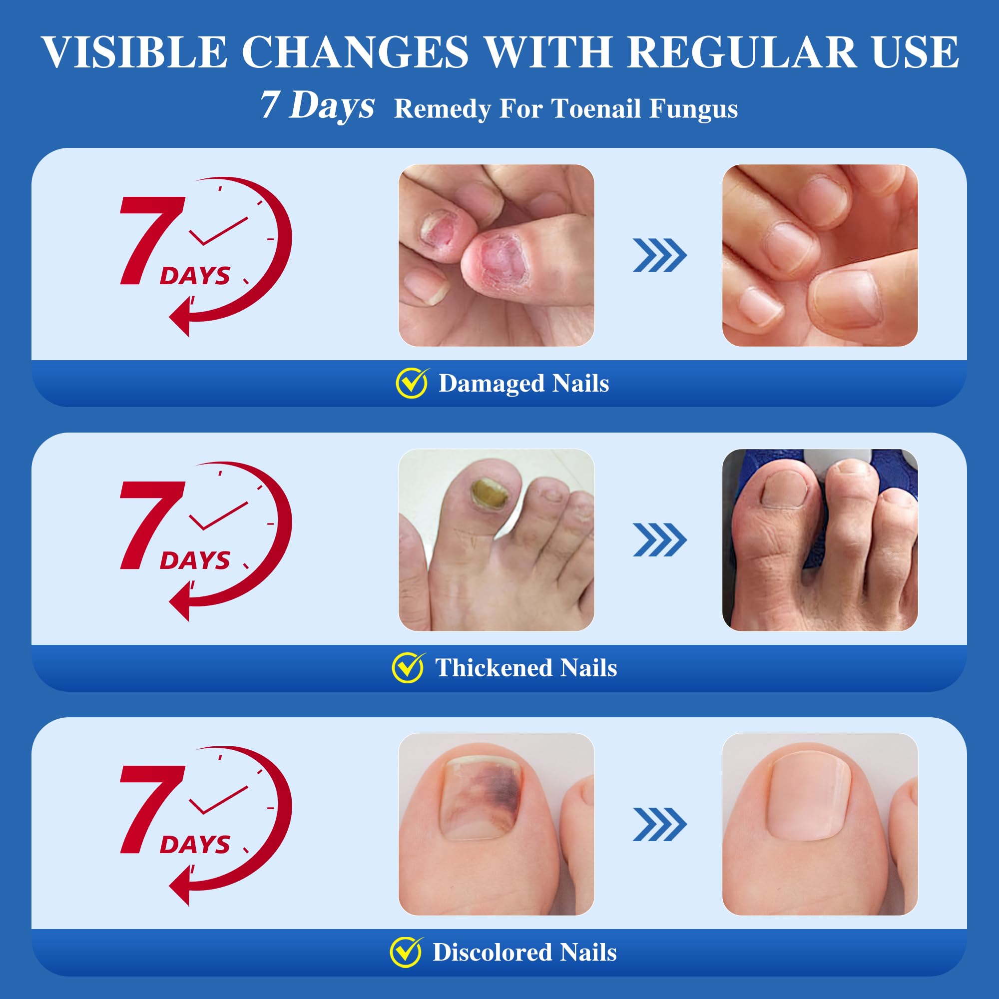 DR.RAPID Toenail Fungus Treatment Extra Strength - Fast-Acting Nail Repair with Tea Tree Oil