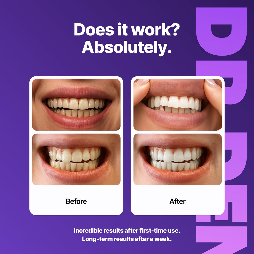 DRDENT Purple Teeth Whitening Strips - Safe for Enamel, 42 Strips