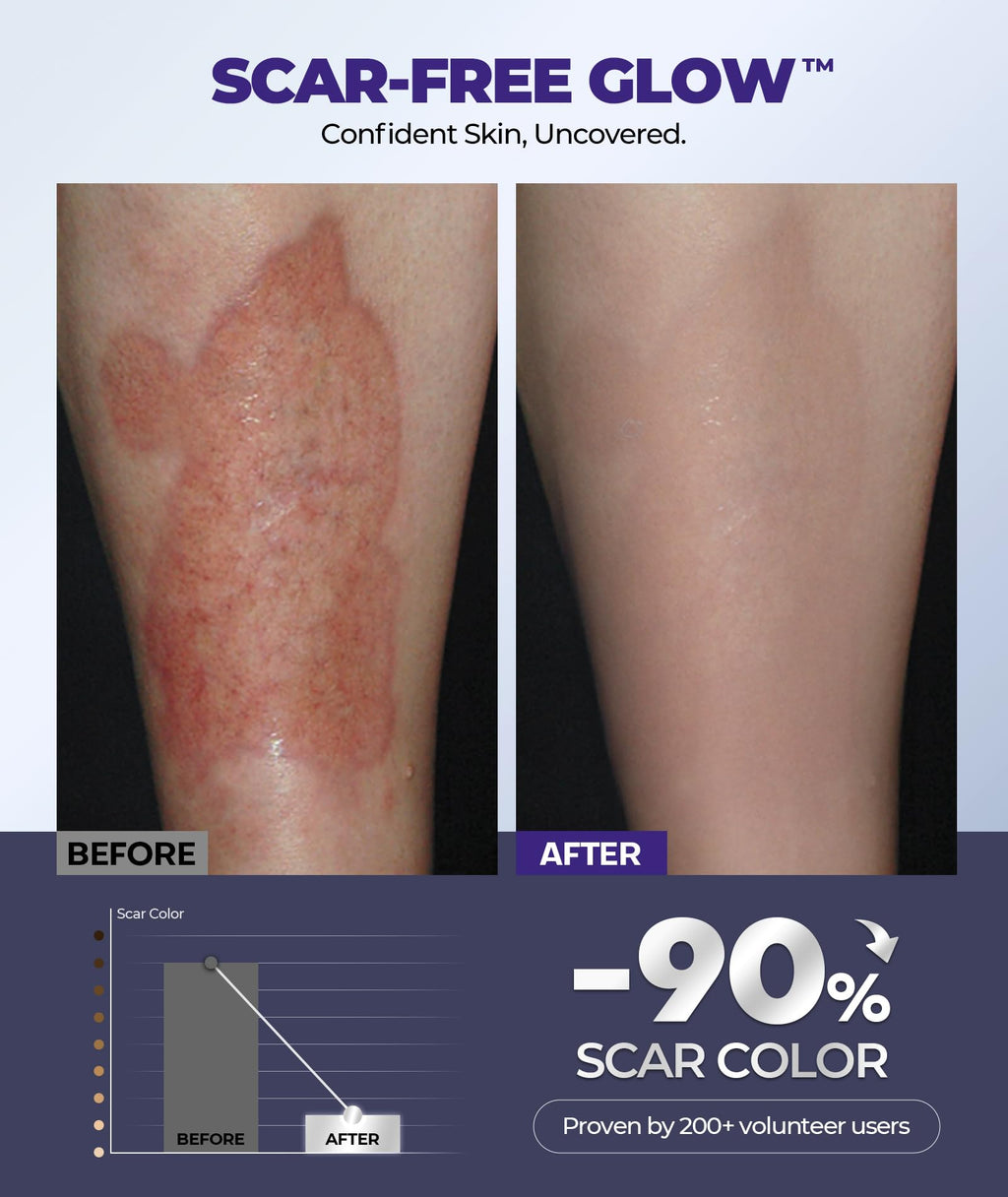 EASEWAVE Silicone Scar Cream with 6.7% Active – Visible in 2 Weeks (55ml)