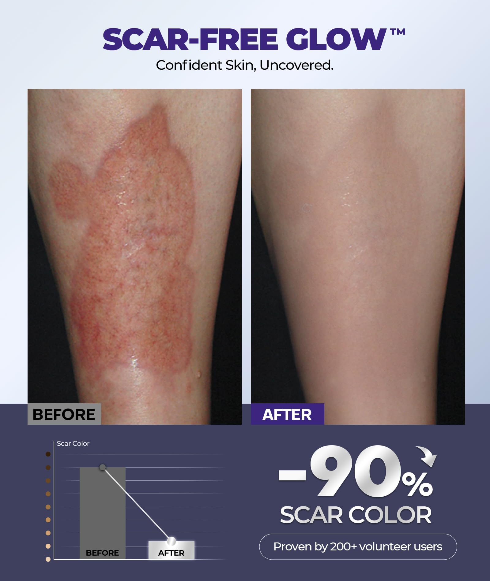 EASEWAVE Silicone Scar Cream with 6.7% Active – Visible in 2 Weeks (55ml)
