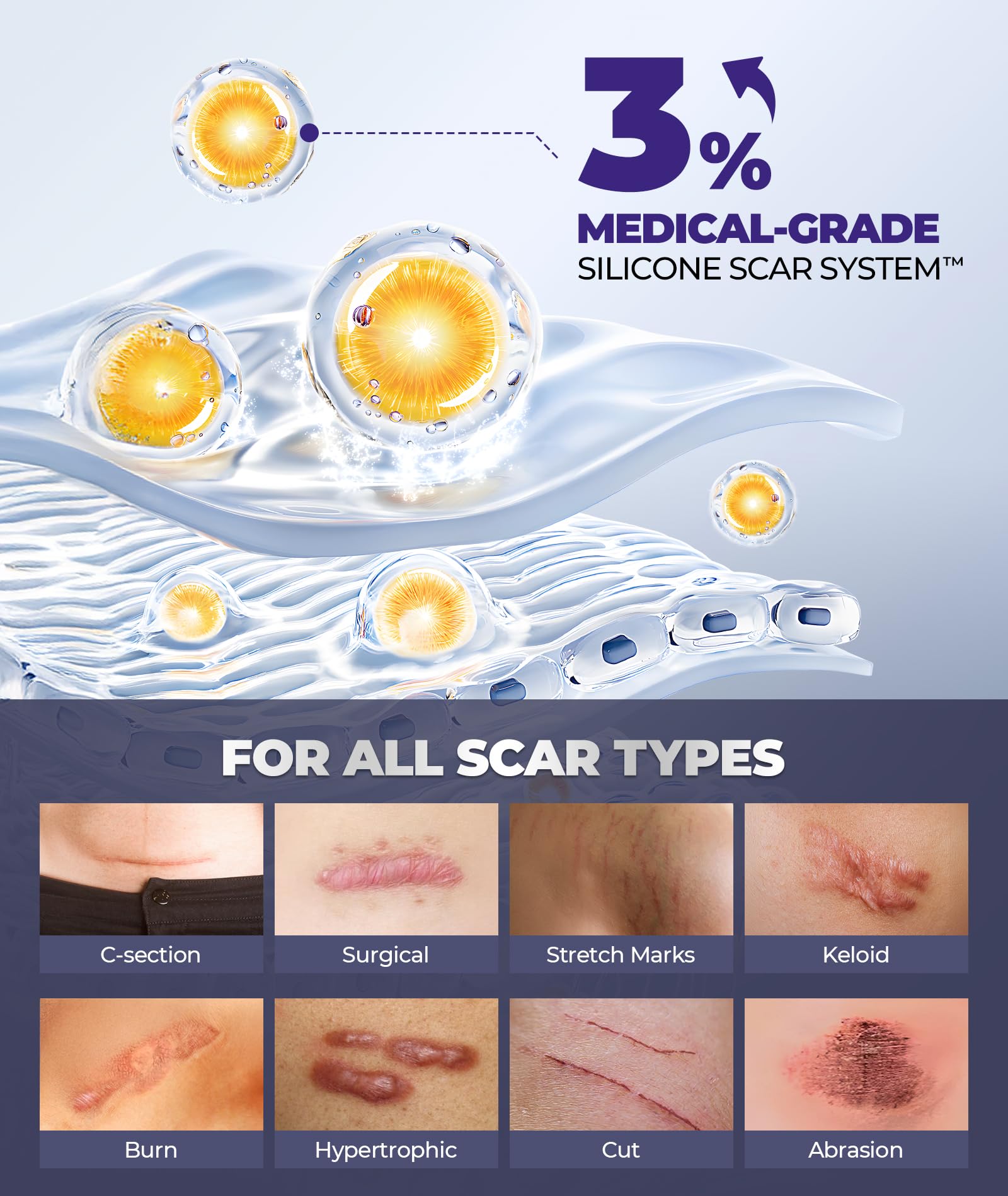 EASEWAVE Silicone Scar Cream with 6.7% Active – Visible in 2 Weeks (55ml)