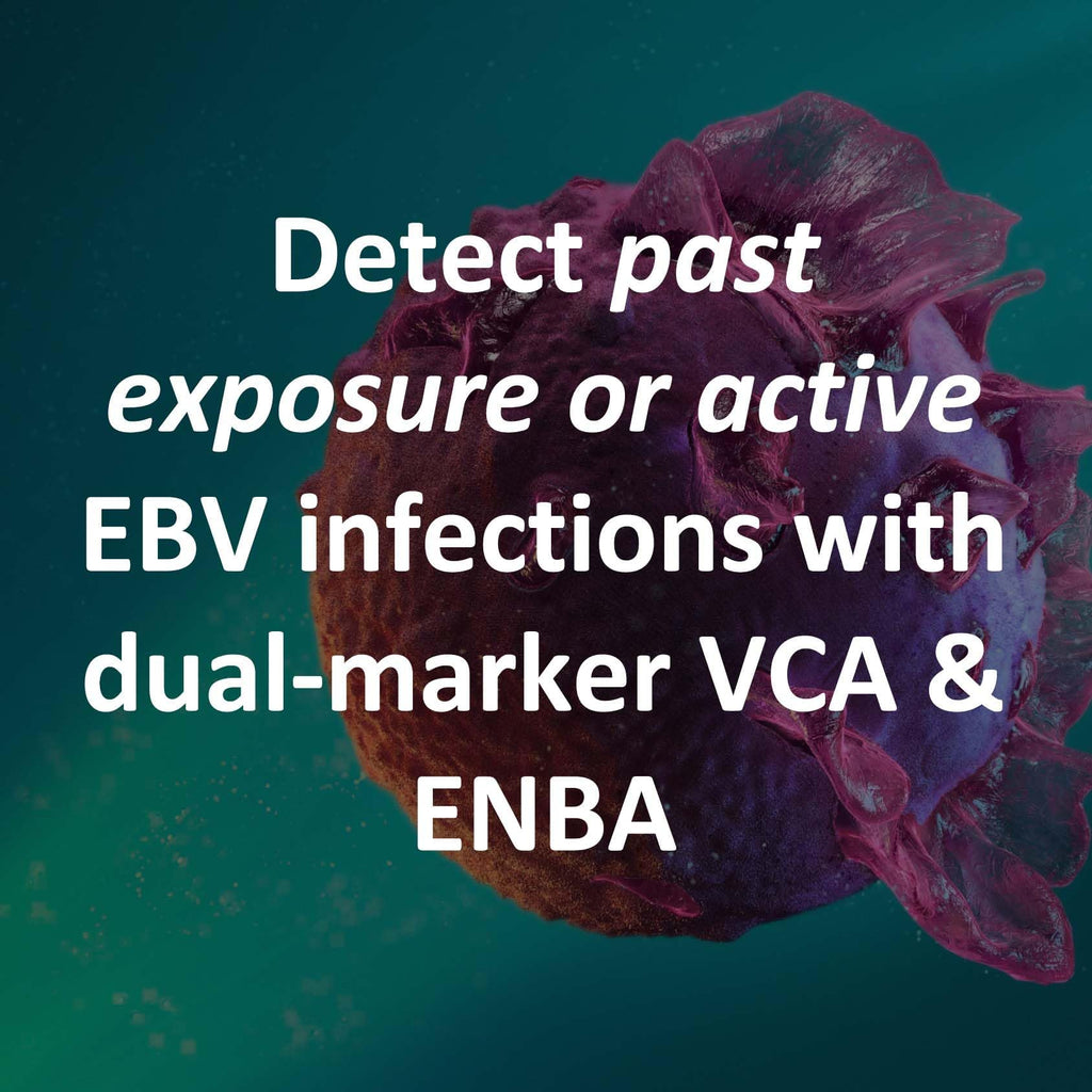 Epstein Barr EBV At-Home Test Kit – IgG VCA & EBNA | 15-Minute Result