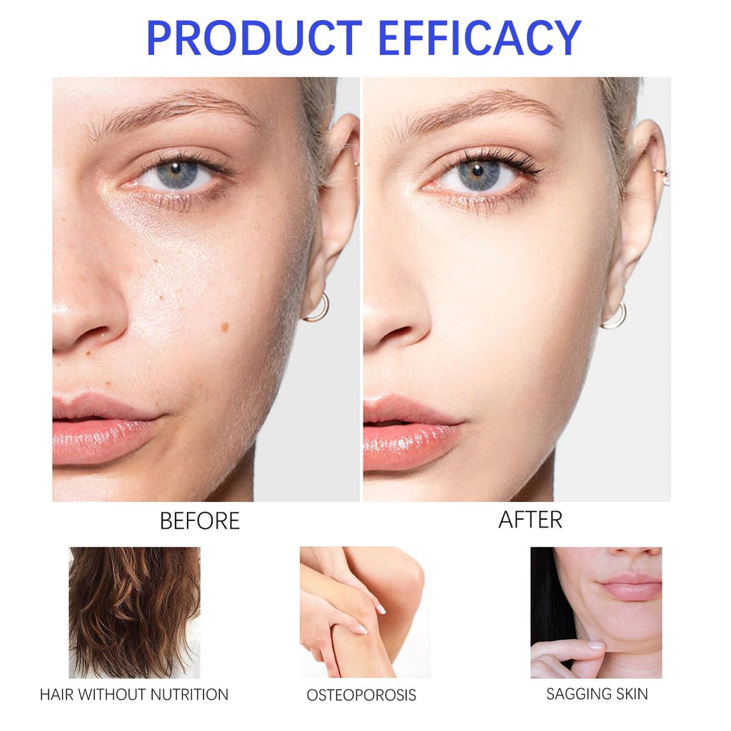 ESUNM Hyaluronic Acid Powder – Low Molecular Weight 100 kDa, 3.52 oz for Skin Hydration & DIY Serum