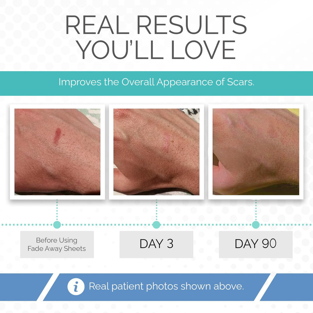 Fade Away Clinically Proven Silicone Scar Sheets – Medical Grade Tape for Surgery, C-Section, Keloids & Tummy Tuck Scars