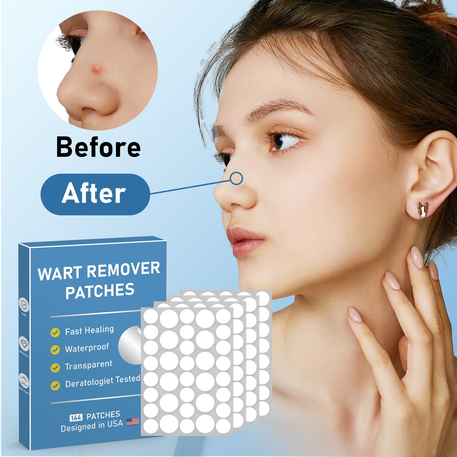 FEDOLOY Wart Remover Patches – Waterproof Hydrocolloid Skin Care Stickers for All Skin Types