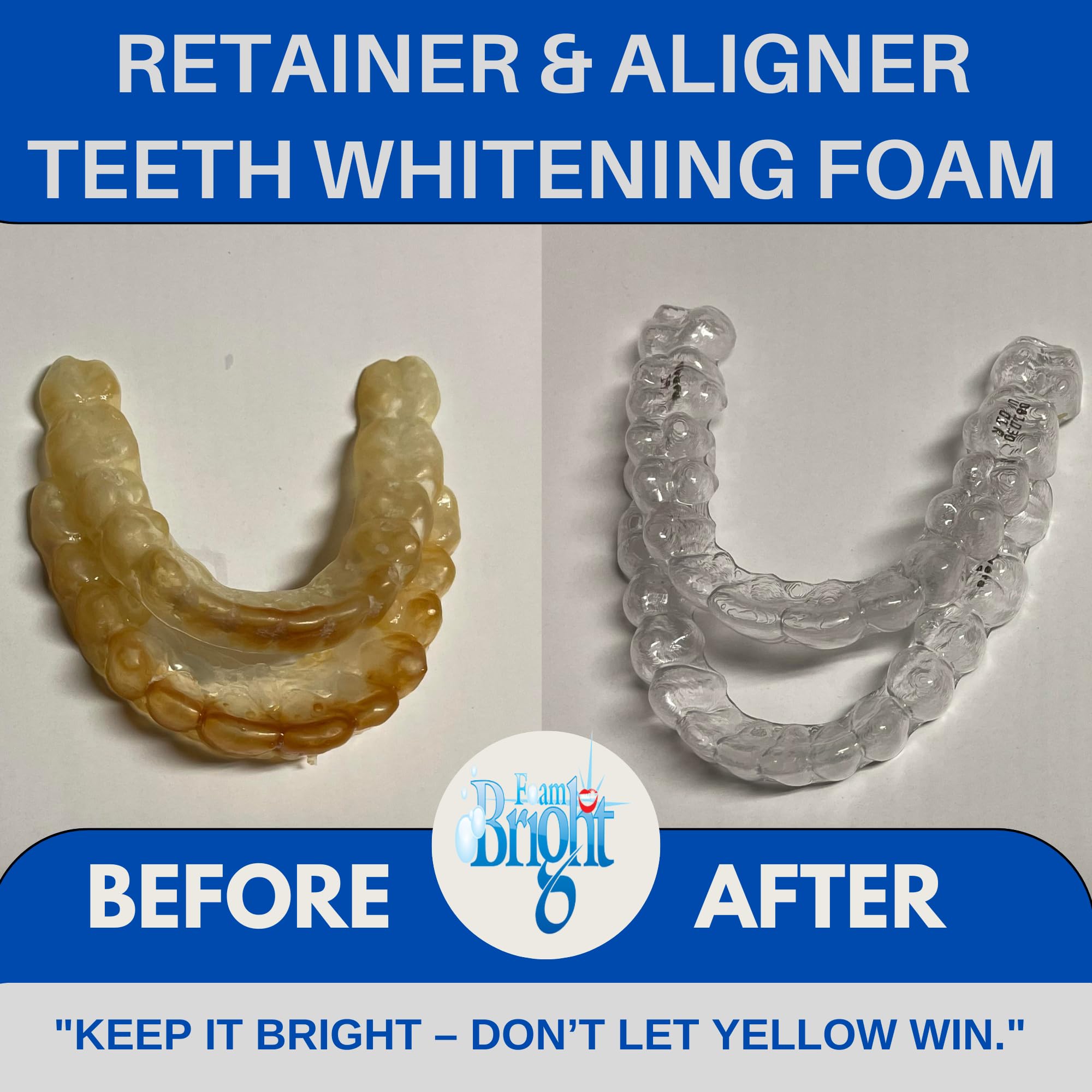 FoamBright Retainer & Aligner Cleaner Foam – Peroxide-Free Oral Care for Invisalign, Braces, and Teeth Whitening
