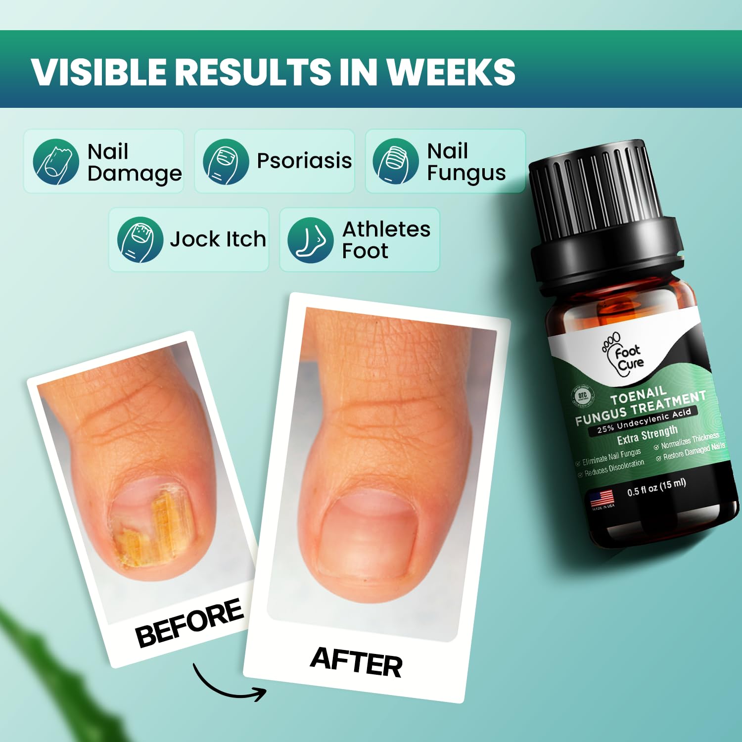 Foot Cure Toenail Fungus Treatment Extra Strength – Athletes Foot & Damaged Nail Repair | Made in USA
