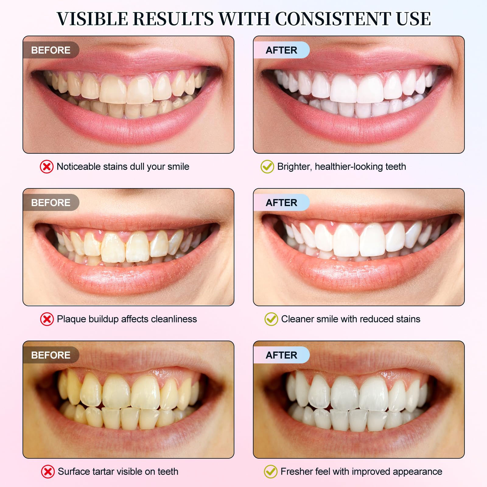 Niacinamide Whitening Toothpaste 2 Pack – Fluoride-Free, Enamel Repair & Fresh Breath