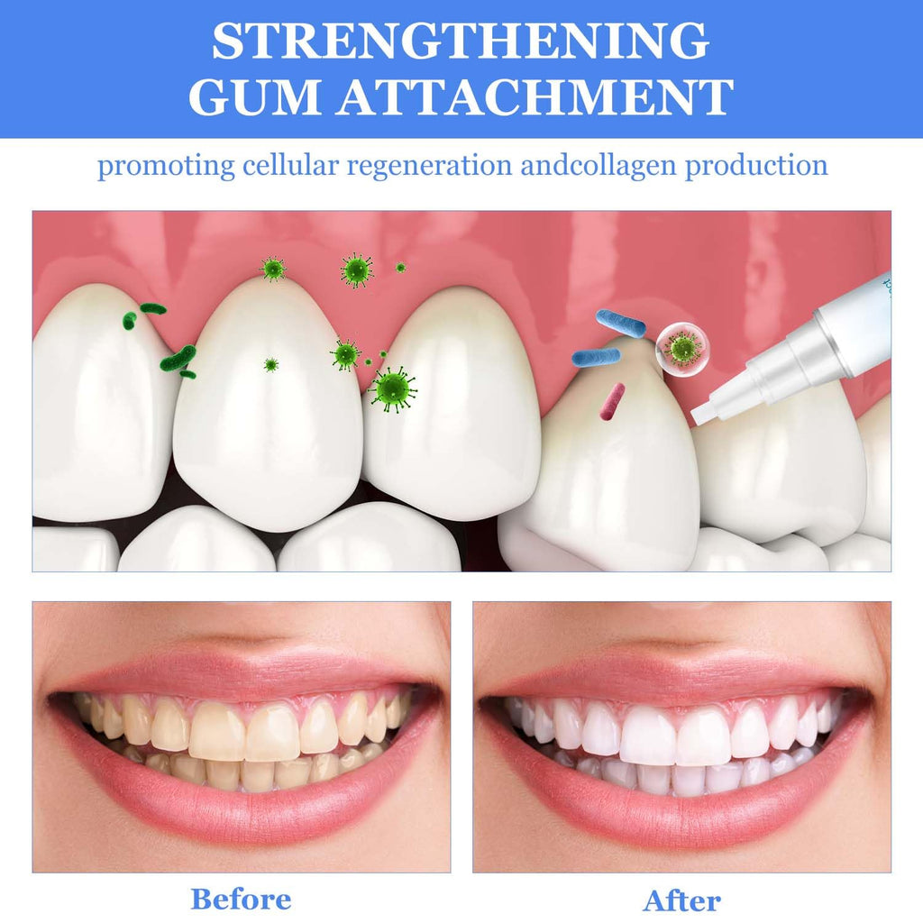 Frosty Neptune Teeth Whitening Pens & Essence (3Pcs) – Fast Stain Removal