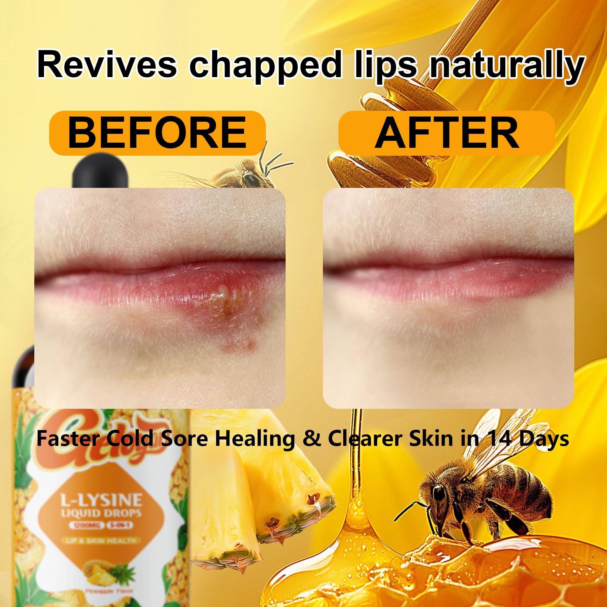 Geloyar L-Lysine Liquid Drops – 1200mg Lysine for Cold Sore, Lip Health & Immune Support | Vegan, 2 fl oz