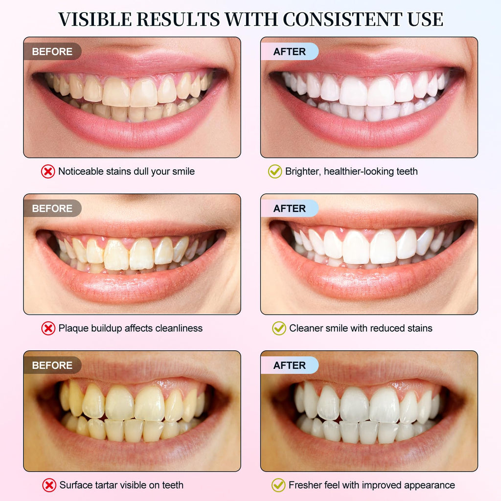 Niacinamide Whitening Toothpaste 2 Pack – Enamel Safe, Fresh Mint & Peach
