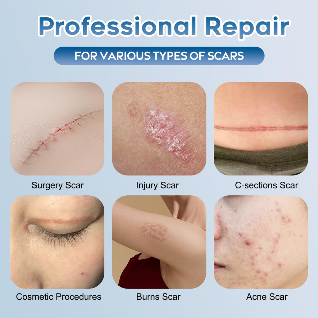 Glowor Advanced Silicone Scar Gel – Face & Body Scar Cream (3.53 oz)