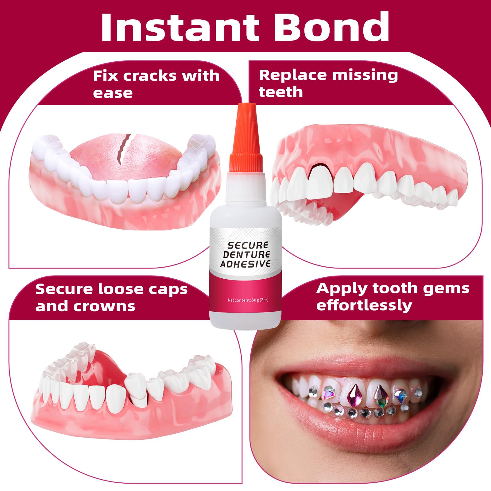 Dental Lab Instant Bonding Glue (1oz) for Denture Repair – Quick Bond, Lasts Days to Weeks