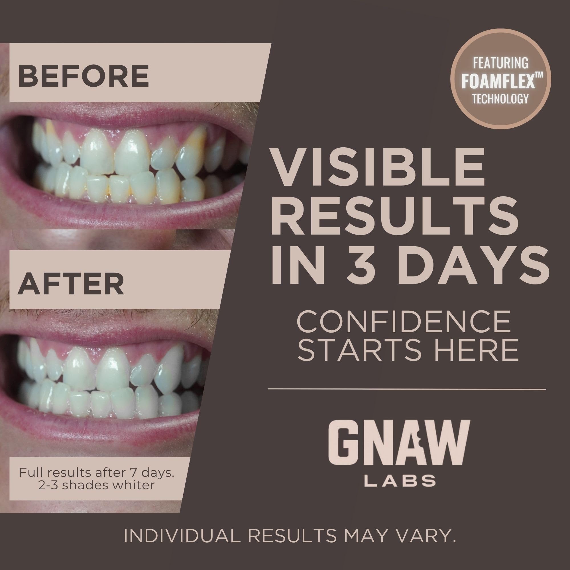 GNAW LABS Teeth Whitening Strips for Men – 14 Treatments
