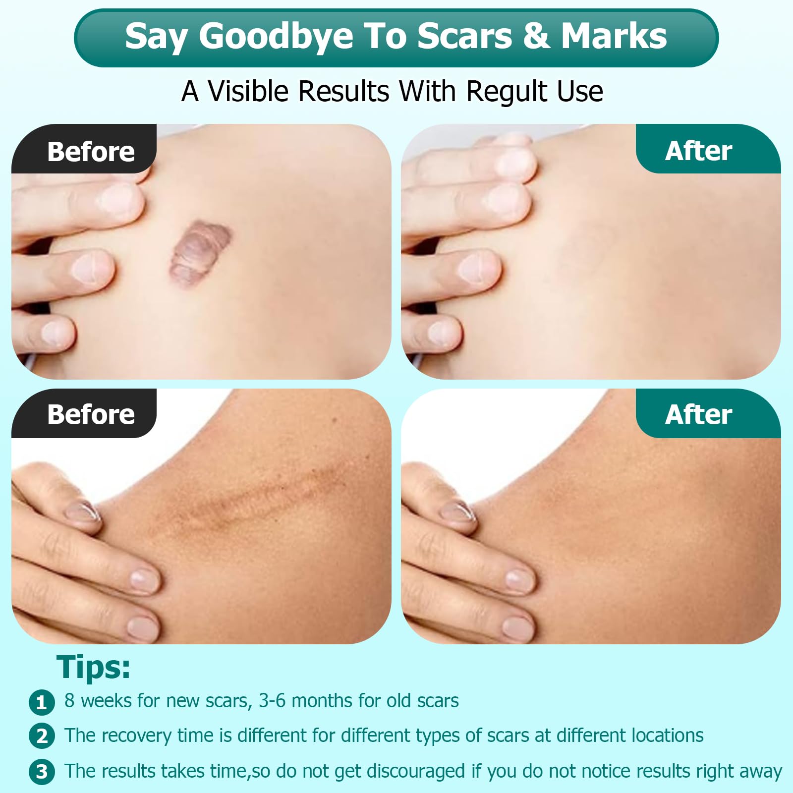 Gowgaw Scar Gel – Advanced Silicone Scar Cream for Surgical & Skin Scars