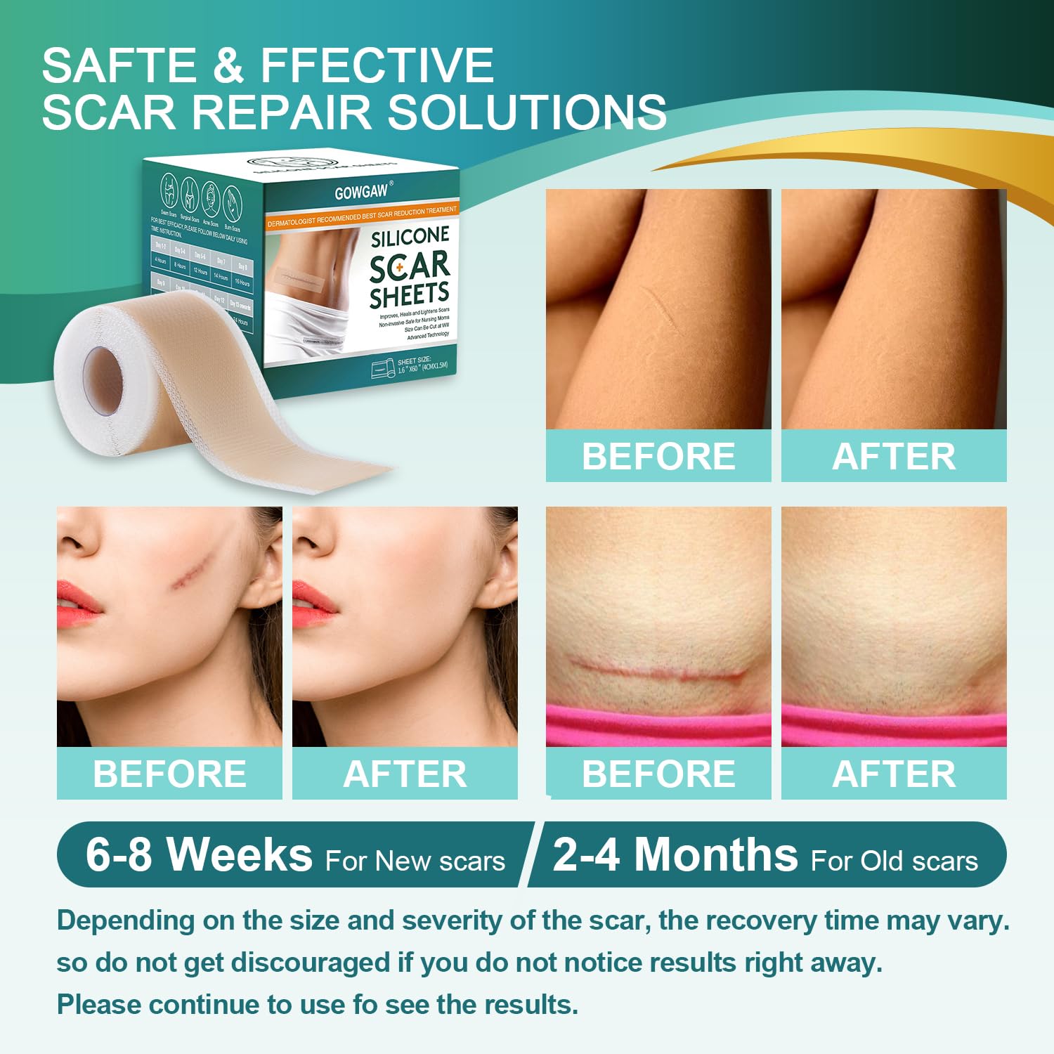 Gowgaw Medical Grade Silicone Scar Sheets | Reusable Scar Tape (1.6” x 60” / 1.5M) for Surgical, C-Section, Burns & Acne