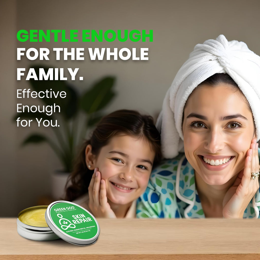 Green Goo Skin Salve | Natural Skin Repair & Daily Moisture – 1.82 oz Large Tin