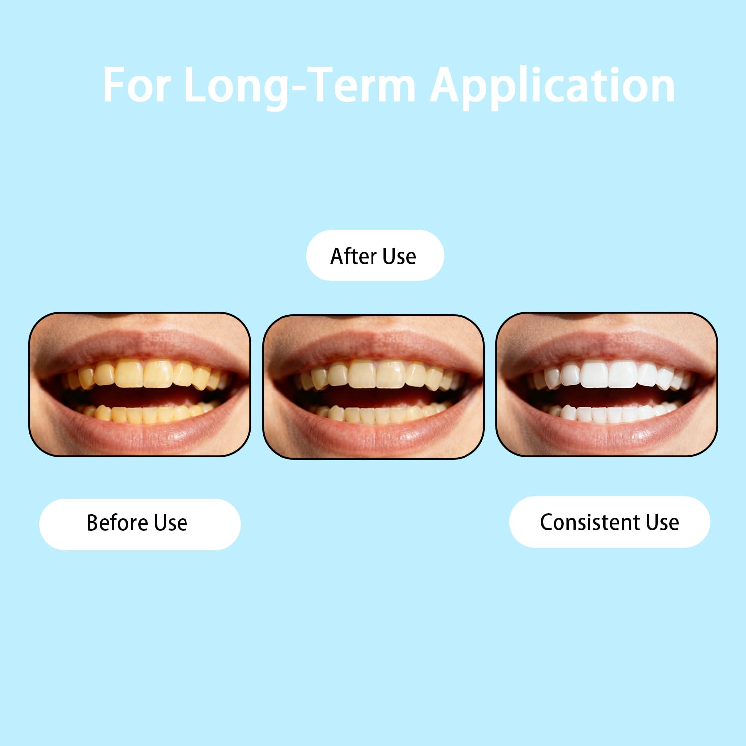 Cavity Healing Tooth Armor Liquid – Transparent Enamel Strengthening with Hydroxyapatite