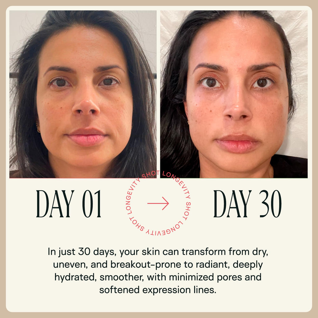 Happy Aging Liquid NAD+ Shot — Liposomal NR + Resveratrol, Twice-Weekly (30 Shots)
