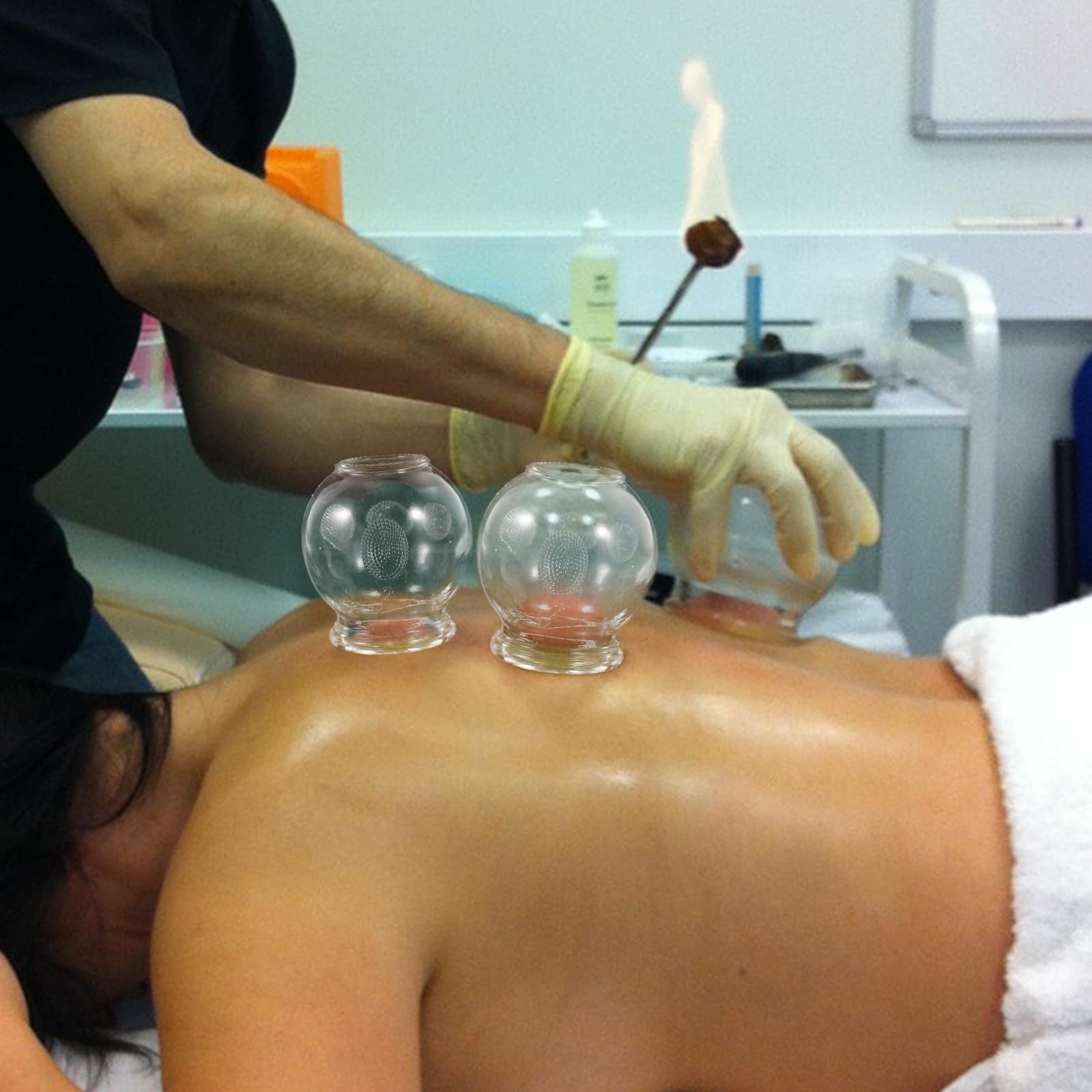 Healvian 8Pcs Glass Fire Cupping Set | Vacuum Suction Cups for Body Therapy, Massage & Metabolism