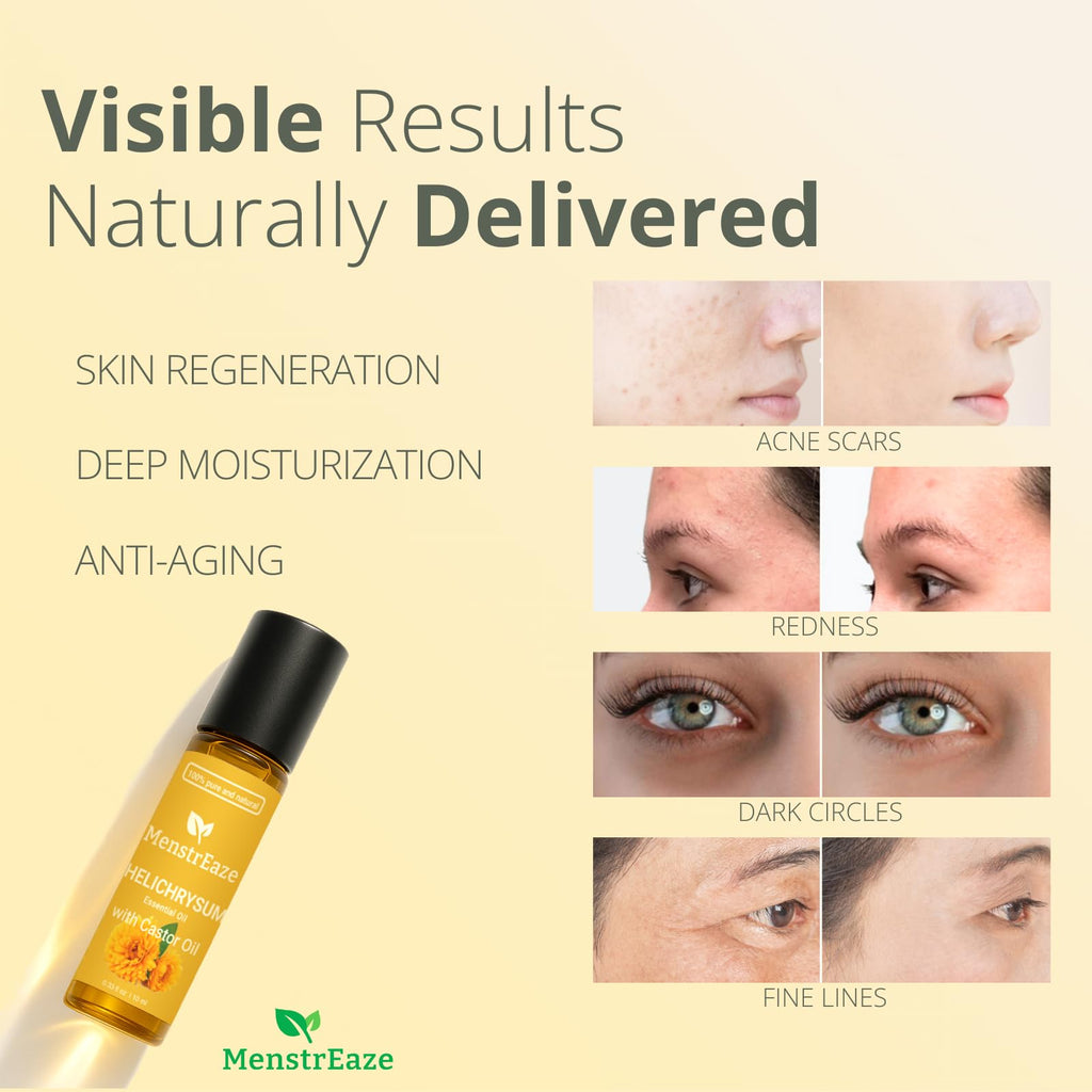 Helichrysum & Castor Oil Roll-On 10ml | High Potency, Acne & Anti-Aging