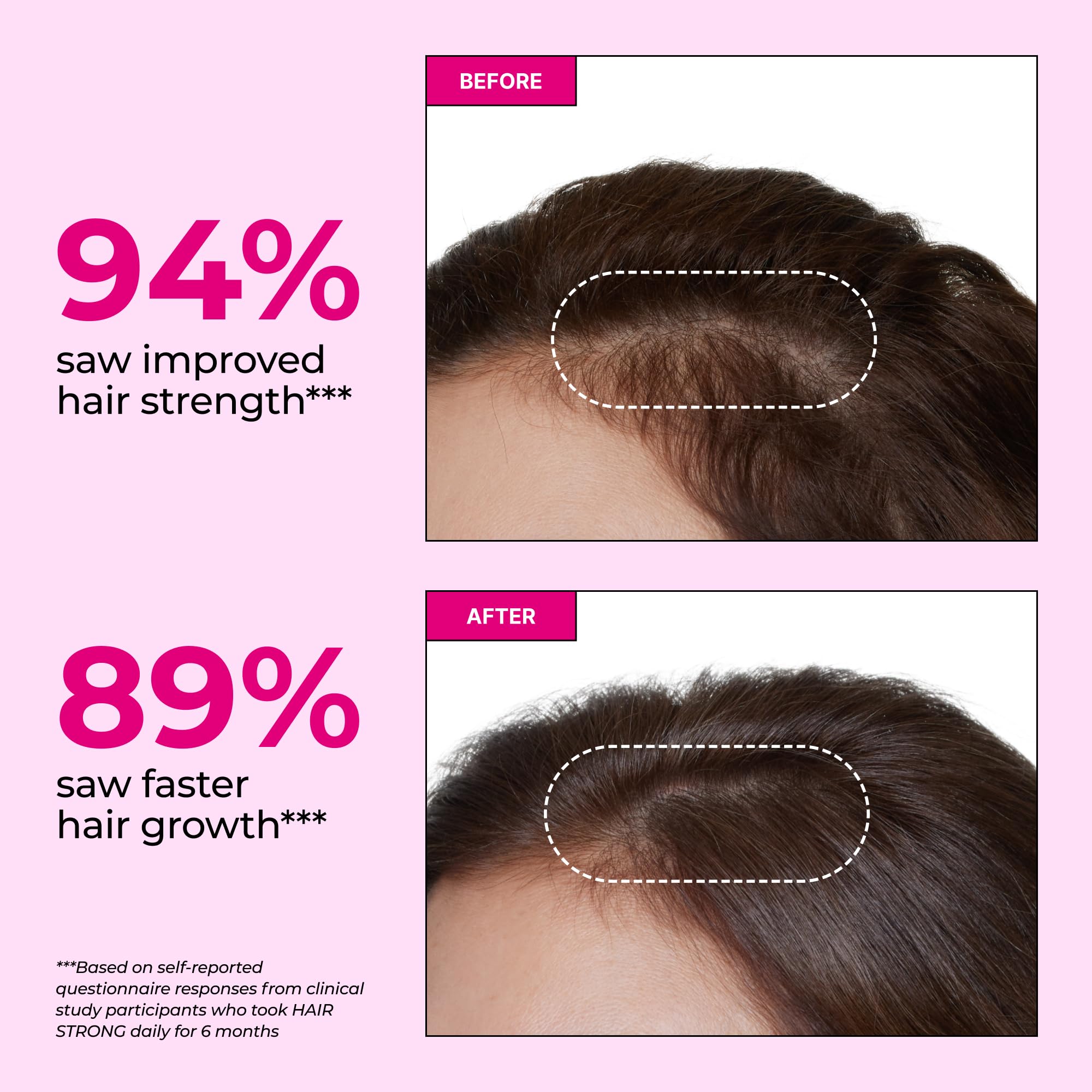 HUM Hair Growth Gummies with Biotin, Zinc & B12 – 60 Gummies