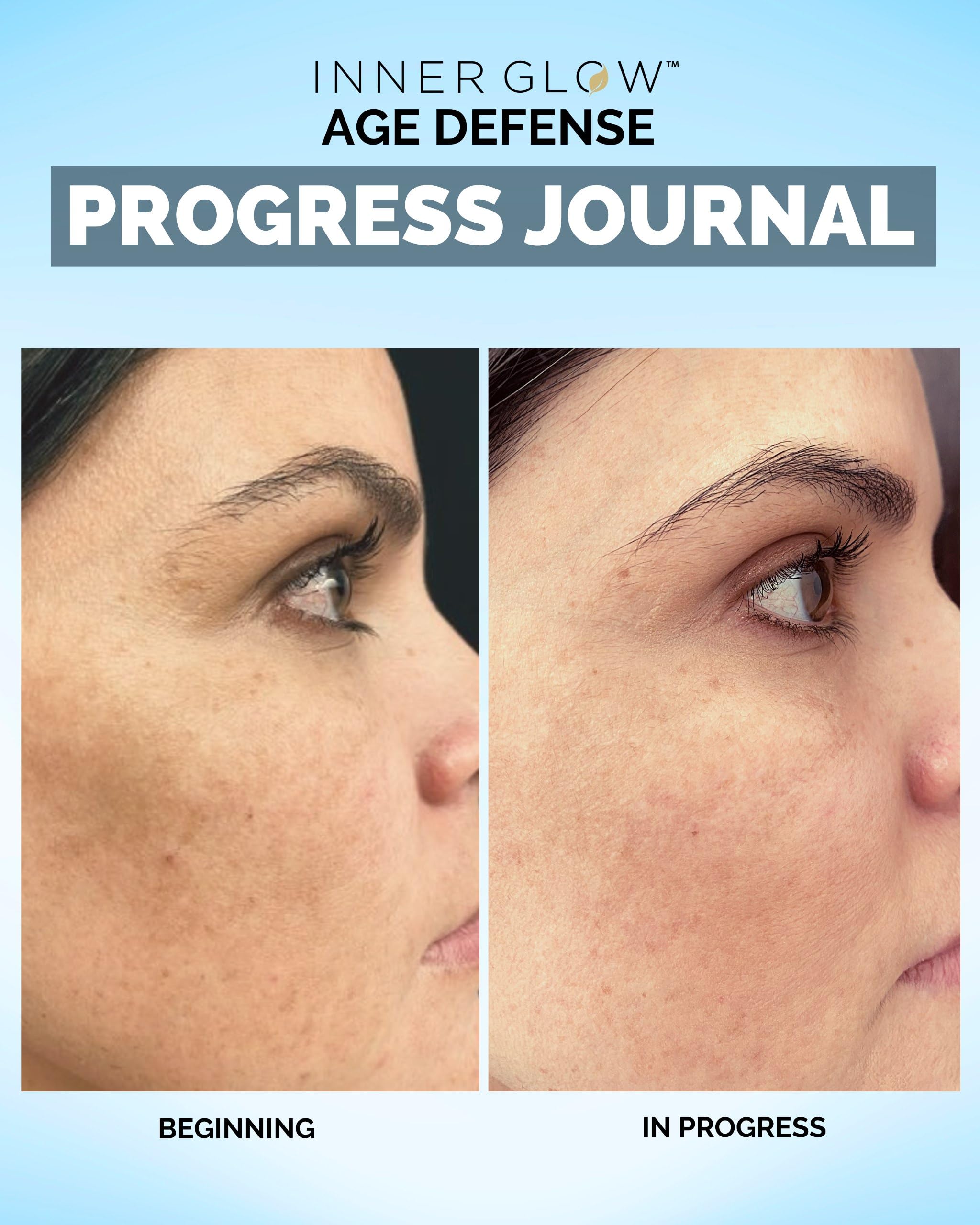 Inner Glow Age Defense Vitamins – Dermatologist & Plastic Surgeon Developed Antioxidant Formula for Photoaging and Melasma – Vegan, Gluten-Free – 60 Capsules