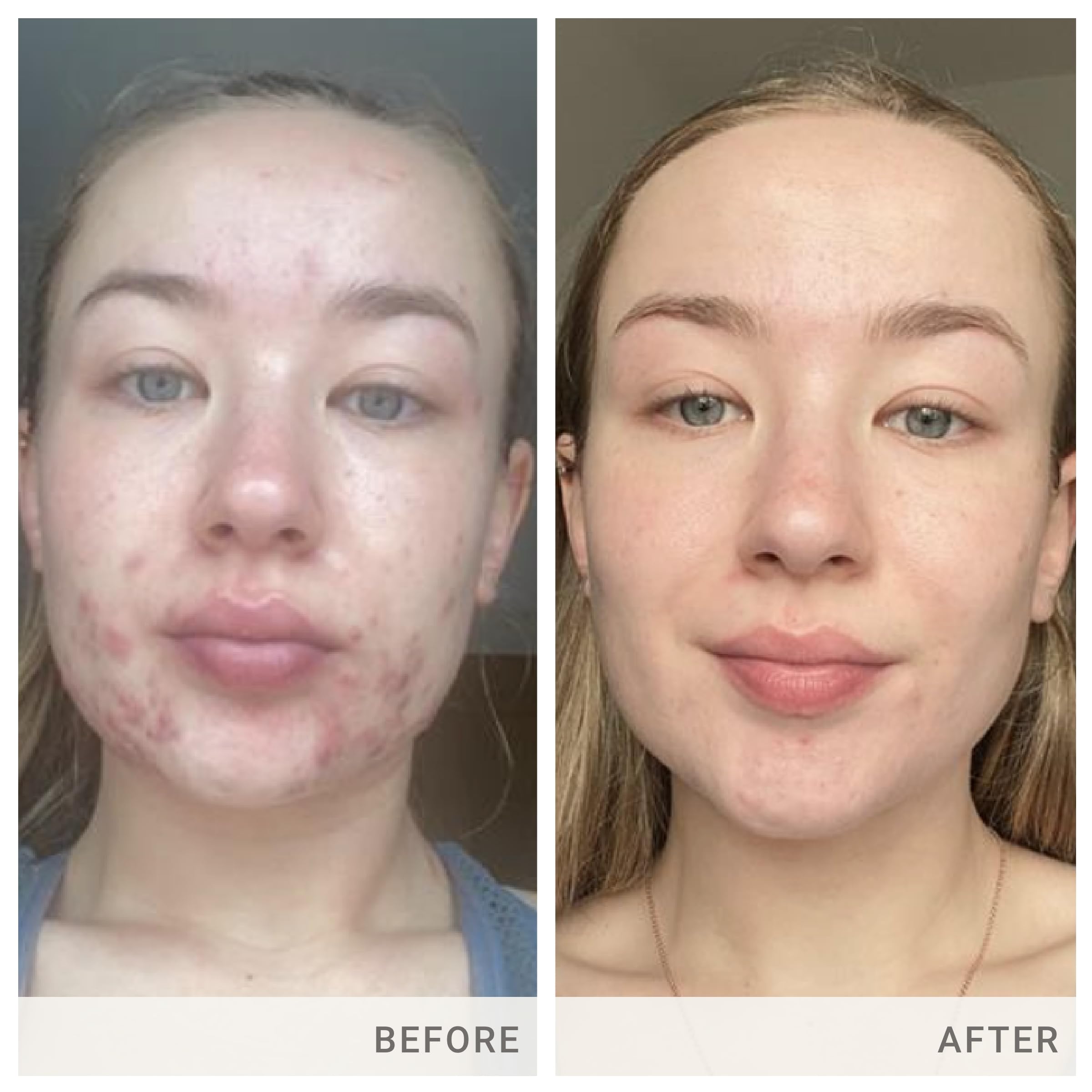 Jane Iredale Skin Accumax Supplement by Advanced Nutrition Programme – 60-Day Supply (Vegan, Gluten-Free)