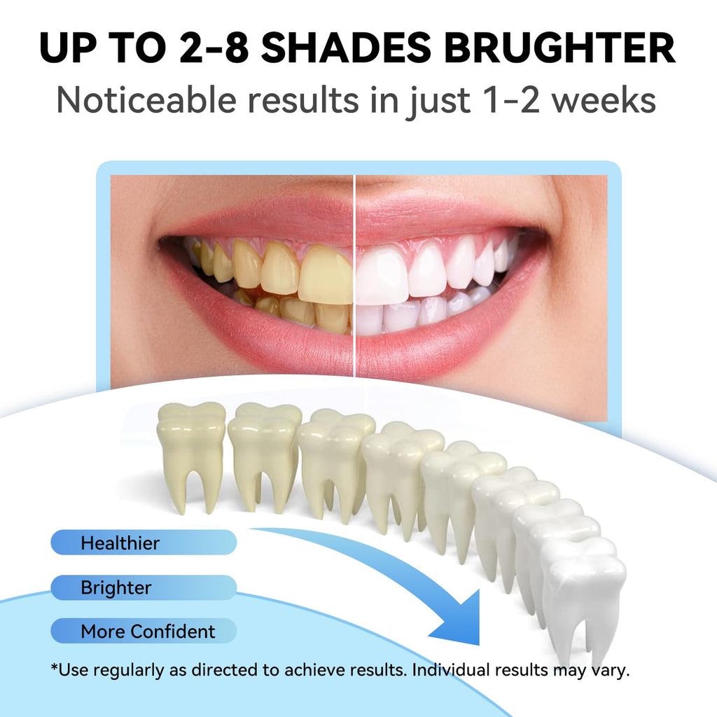 JTF Teeth Whitening Gel Kit – 35% Carbamide Peroxide, 5 Gels + Remineralization (Mint)