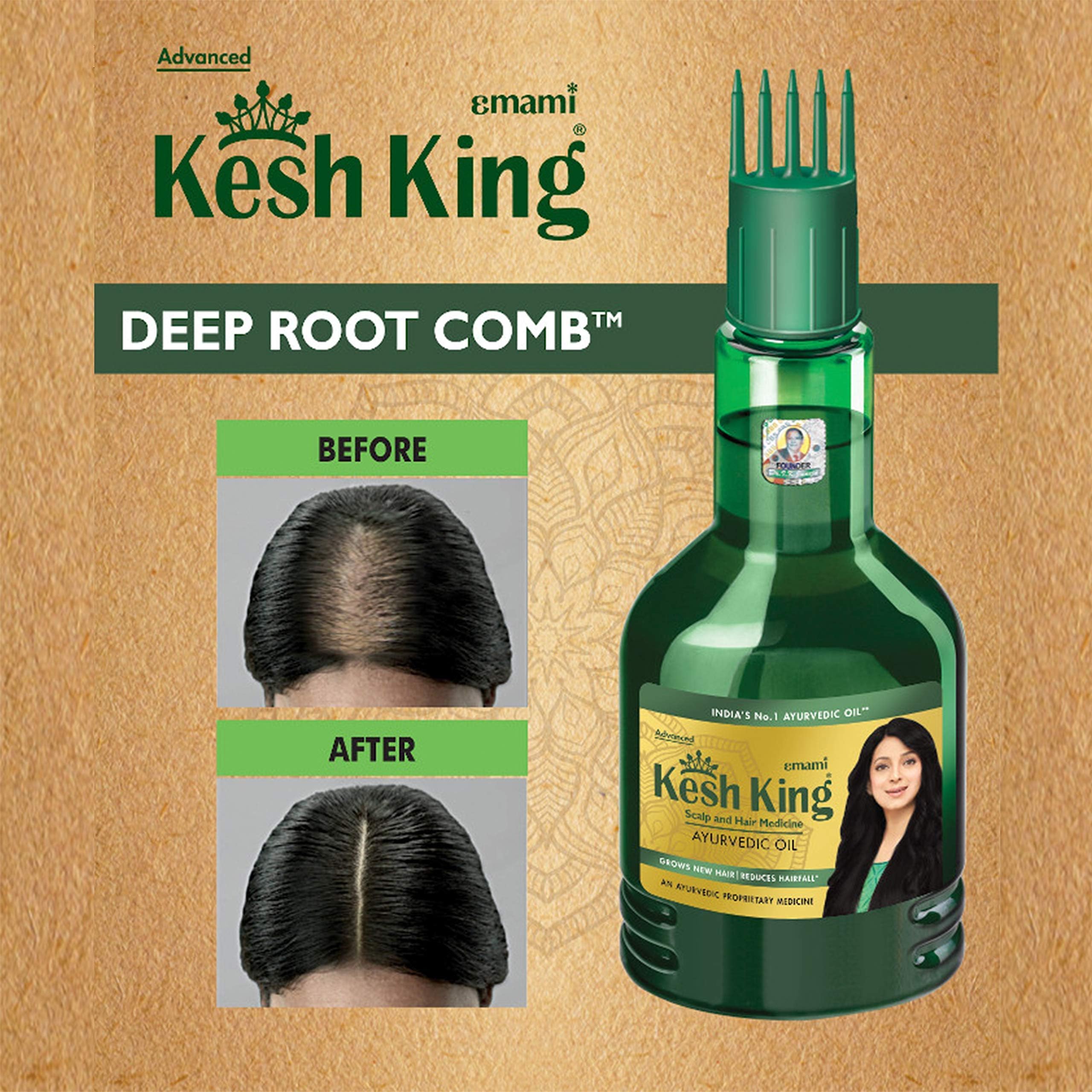 Kesh King Ayurvedic Hair Oil - 300ml | 21-Herb Formula for Hair Growth & Reduced Hairfall