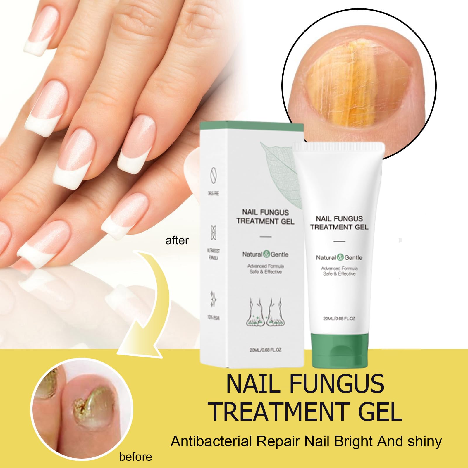 KUNLEN Nail Fungus Gel & Cream – 2pc Nail Repair Oil Serum