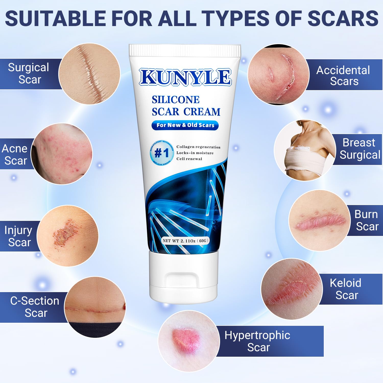 Kunyle Scar Cream | Silicone Scar Gel for Surgical Scars, Keloids & Stretch Marks | 60g