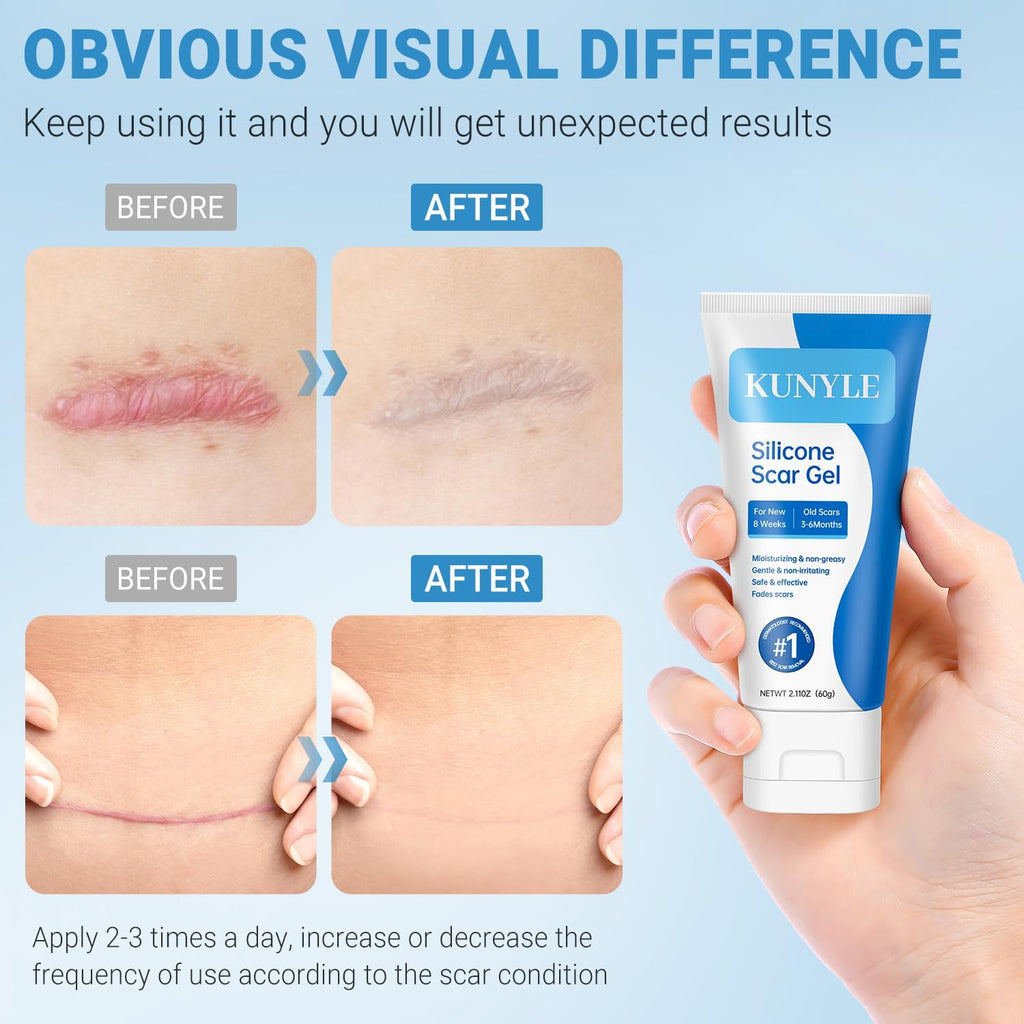 Kunyle Silicone Scar Gel – Advanced Scar Cream for Surgical Scars, Stretch Marks & Keloids (60g)