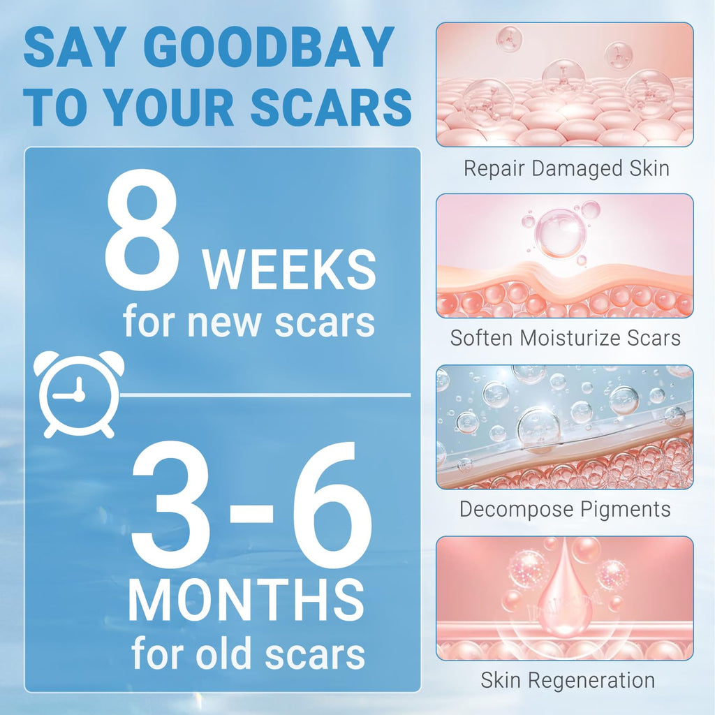 Kunyle Silicone Scar Gel – Advanced Scar Cream for Surgical Scars, Stretch Marks & Keloids (60g)