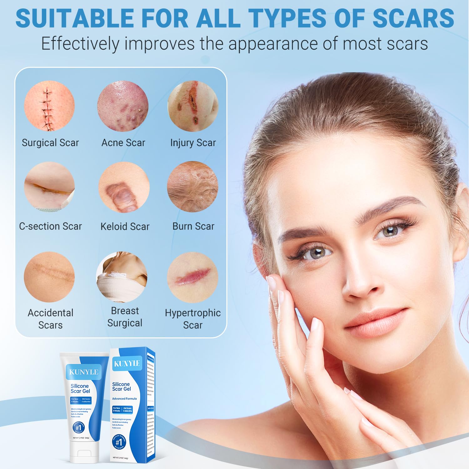 Kunyle Silicone Scar Gel – Advanced Scar Cream for Surgical Scars, Stretch Marks & Keloids (60g)