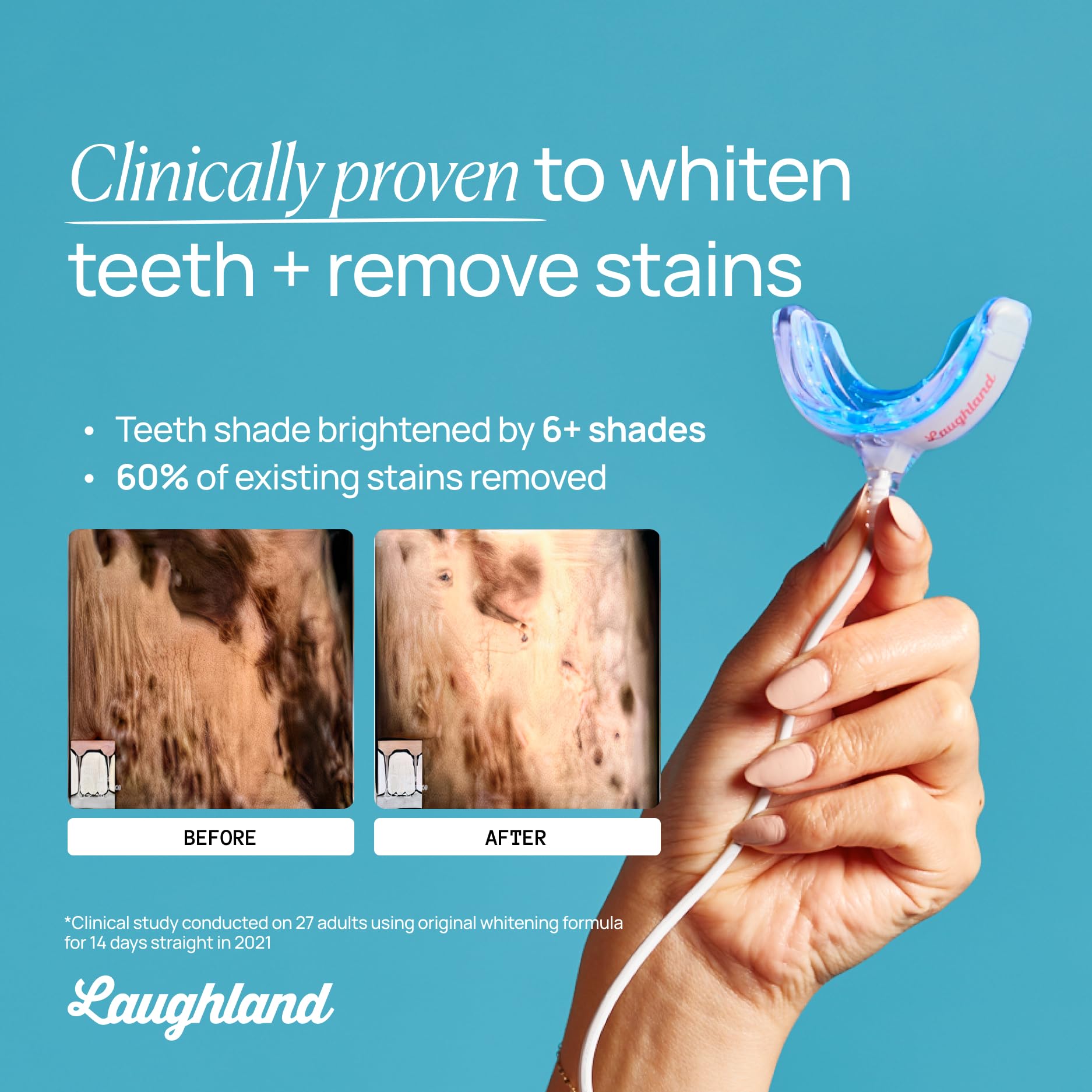 Laughland Teeth Whitening Kit – Phone-Powered LED Mouthpiece, 6+ Treatments for Sensitive Teeth