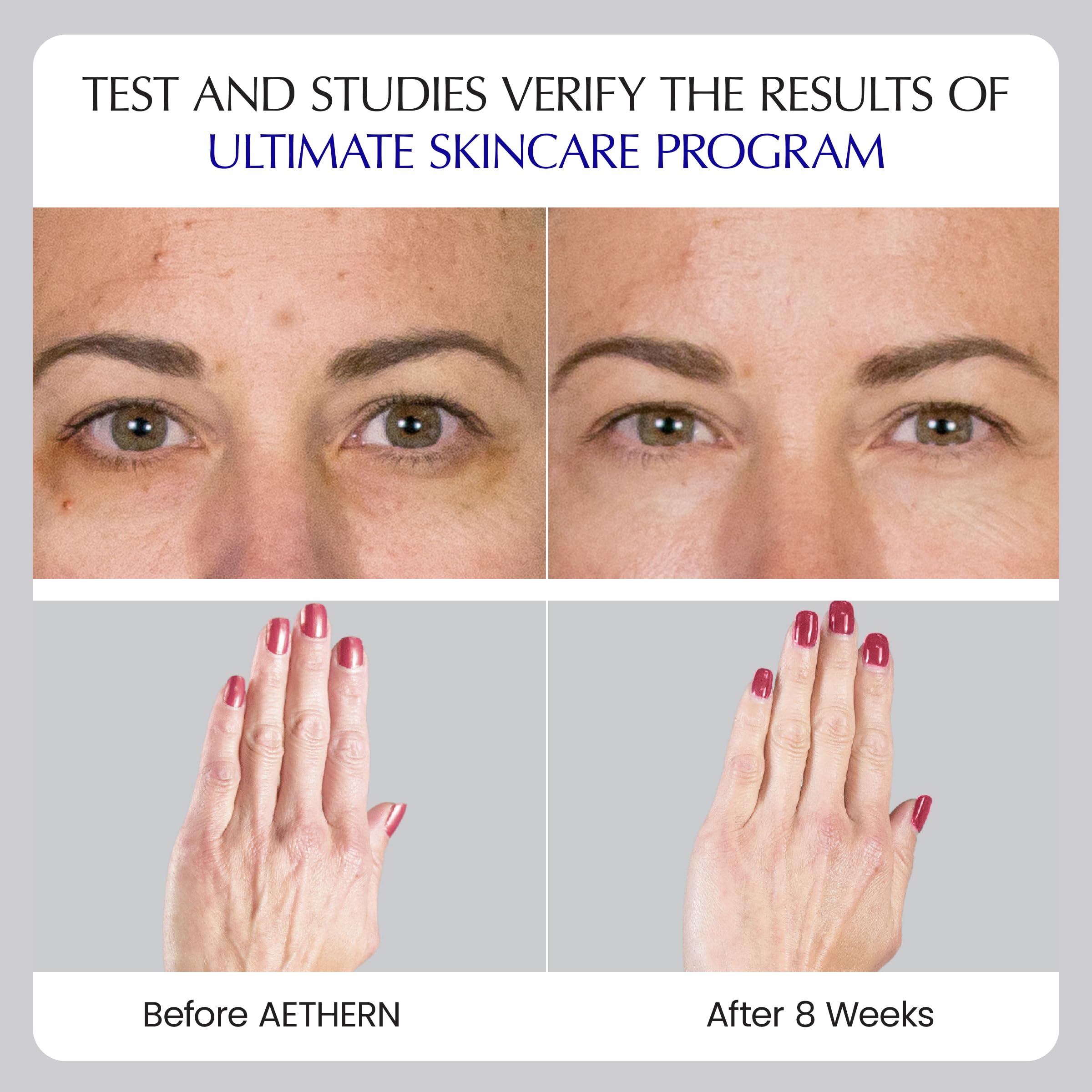 Liquid Skin Care Supplement with Collagen + Hyaluronic Acid – Ready-to-Drink, Clinically Proven for Glowing, Hydrated, and Firm Skin | UV Protection | 28 Servings | Ultimate Skincare Program