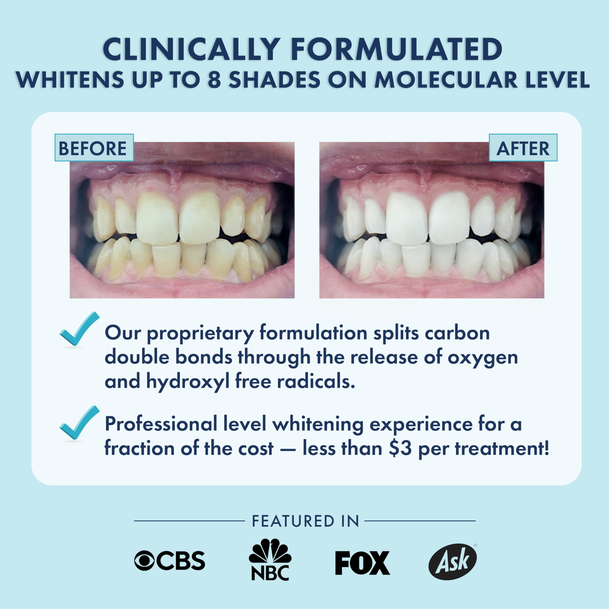 LIVFRESH Teeth Whitening Strips – 28 Strips, 14 Treatments | Enamel Safe