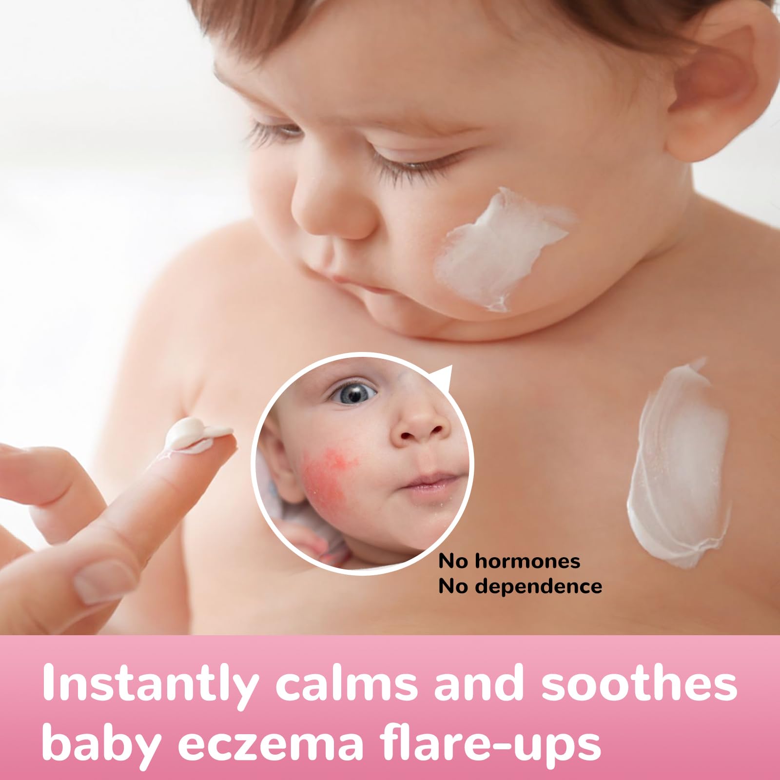 LMNOOP Baby Eczema Relief Cream | All-Natural Herbal Formula 3.53oz