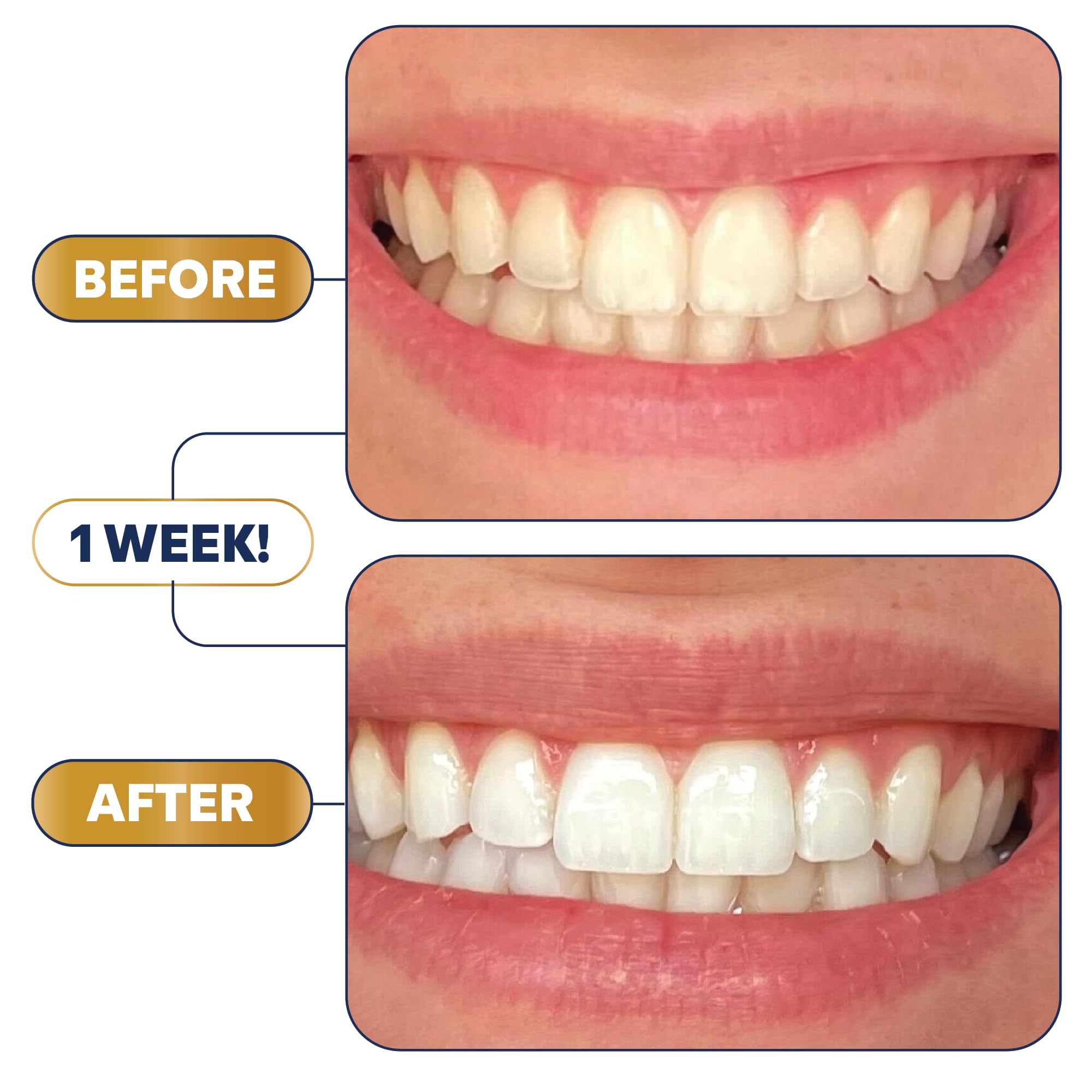 Lumineux Teeth Whitening Strips Kit – 9 Treatments | Peroxide Free, Enamel Safe, Sensitivity Free, Dentist Formulated