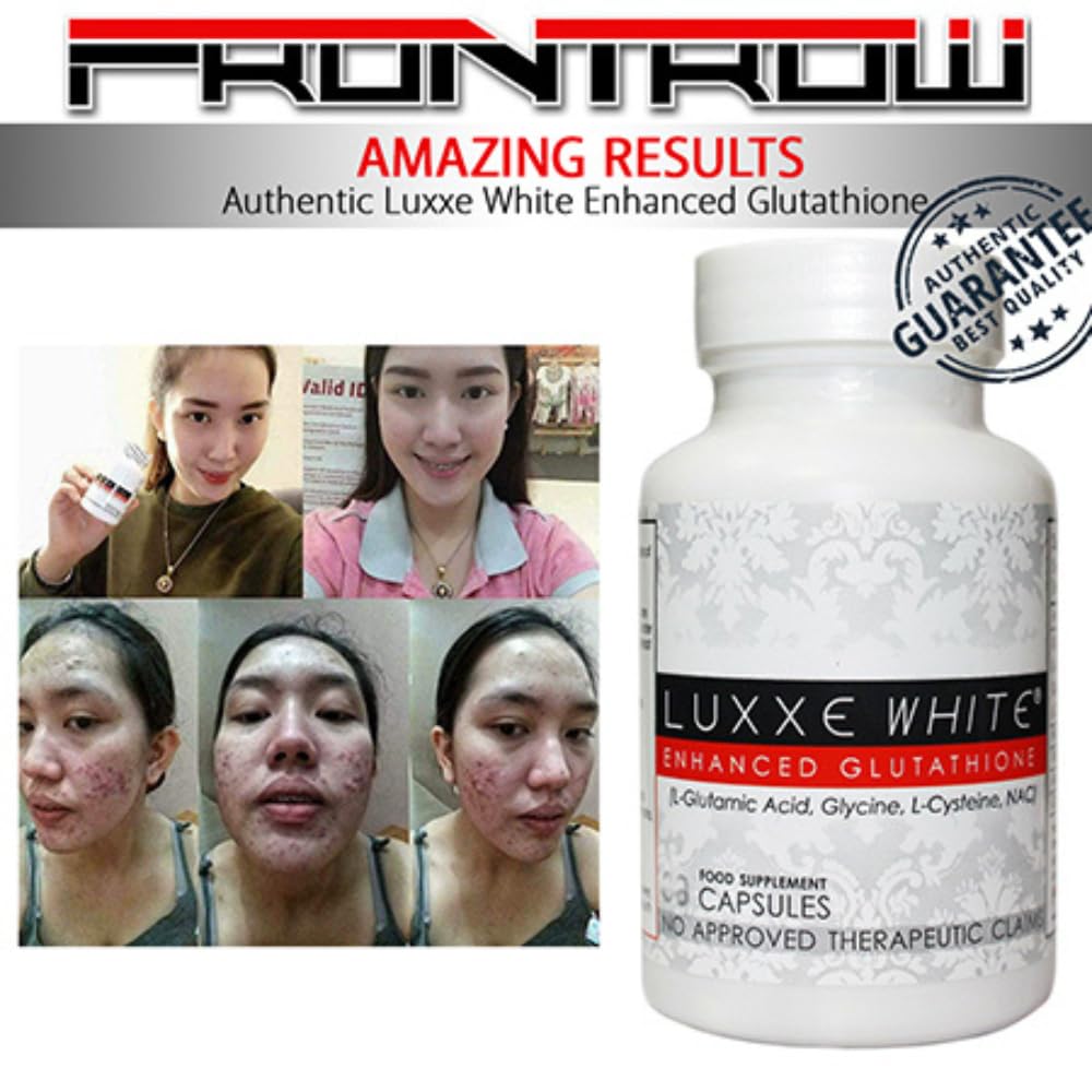 Luxxe White – Glutathione, Vitamin C & Alpha Lipoic Acid for Radiant Skin
