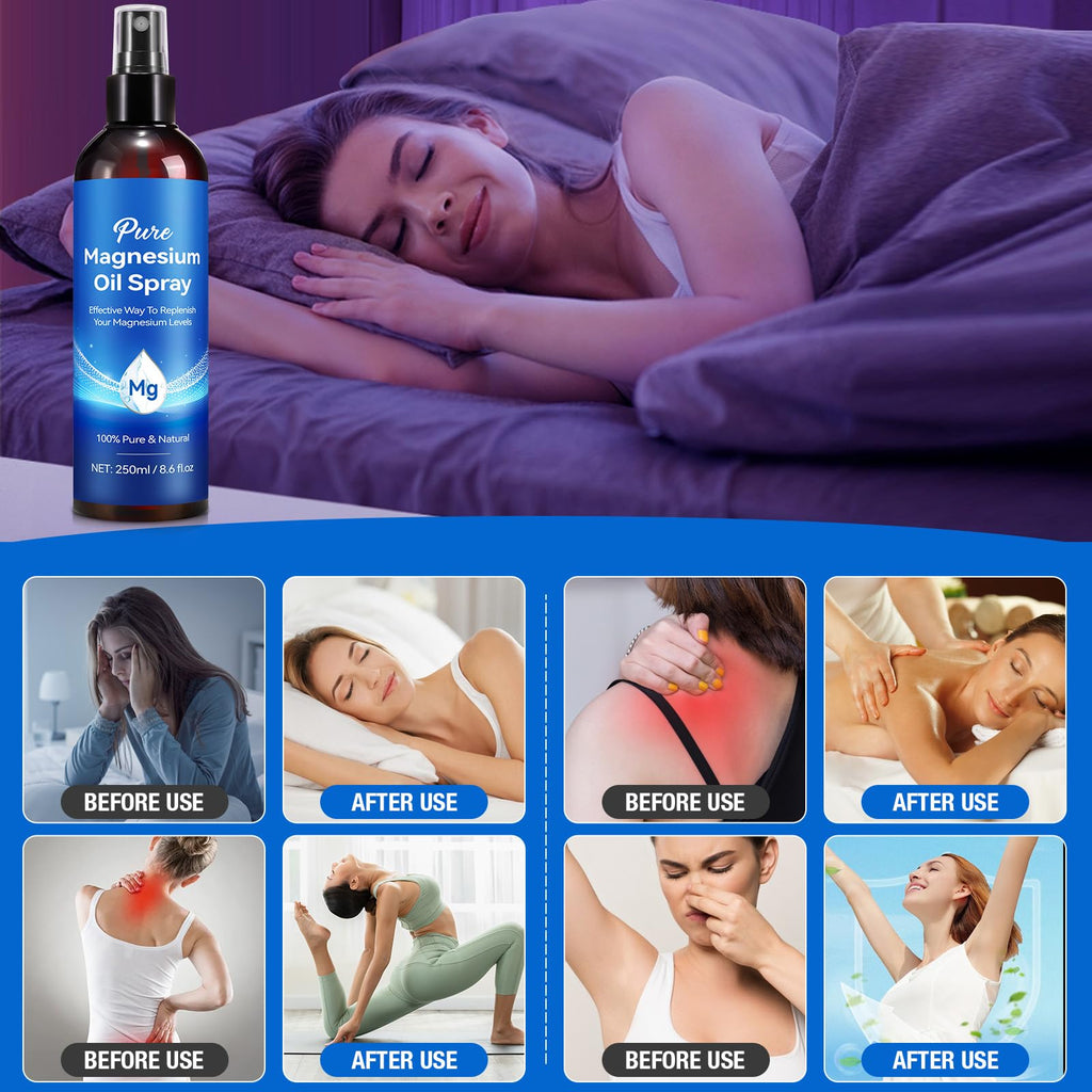 Magnesium Oil Spray 8.6 Fl Oz – Pure Topical Magnesium for Skin, Feet & Body