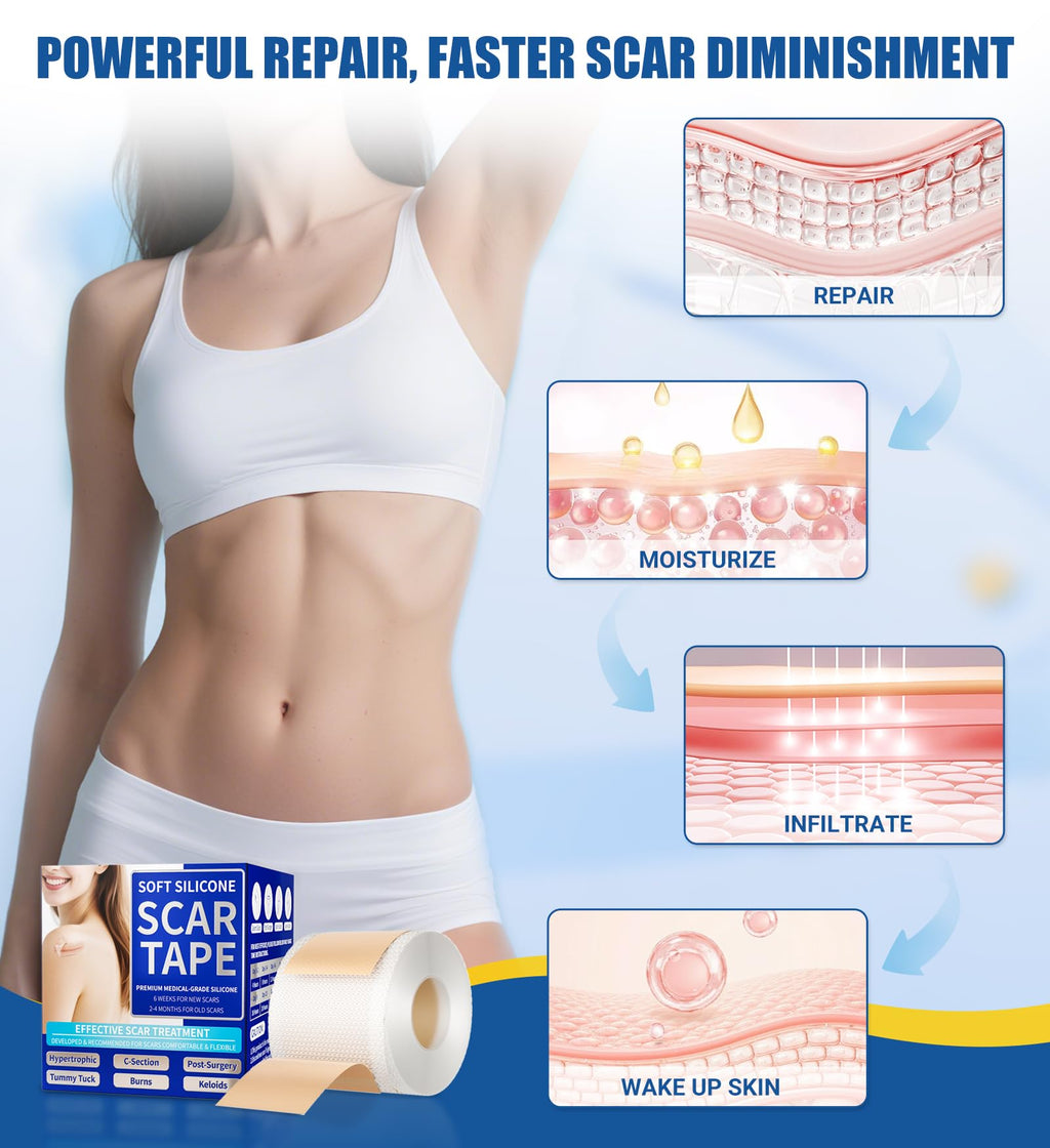 MasterMo Medical Grade Silicone Scar Sheets & Tape – 1.6x60 Roll, Ultra Soft & Hypoallergenic