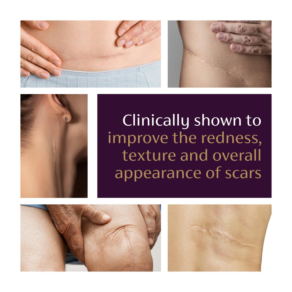 Mederma Advanced Scar Gel - Visibly Reduces Old & New Scars | Acne, Surgery, Burns, Injury & Stretch Marks | 0.70 Oz (20g)