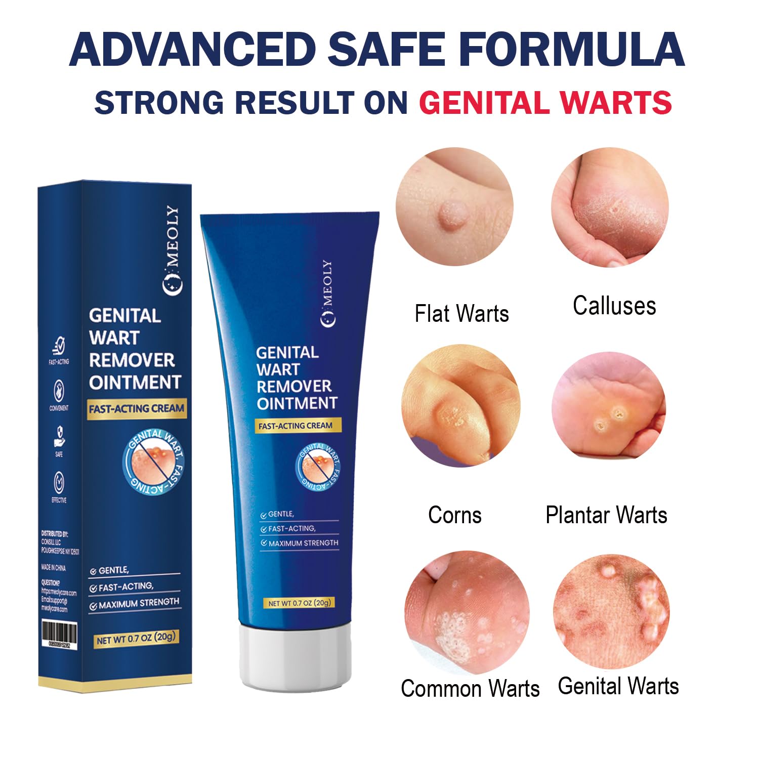 MEOLY Genital Wart Remover Cream: Fast-Acting Salicylic Acid Ointment