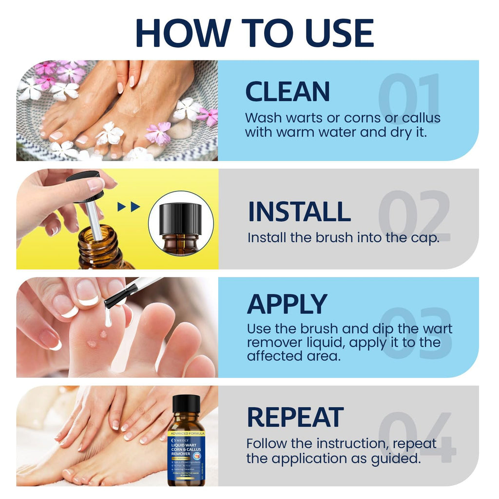 MEOLY Fast-Acting Wart Remover Freeze Off – Plantar Warts, Corns & Calluses, 30 ml