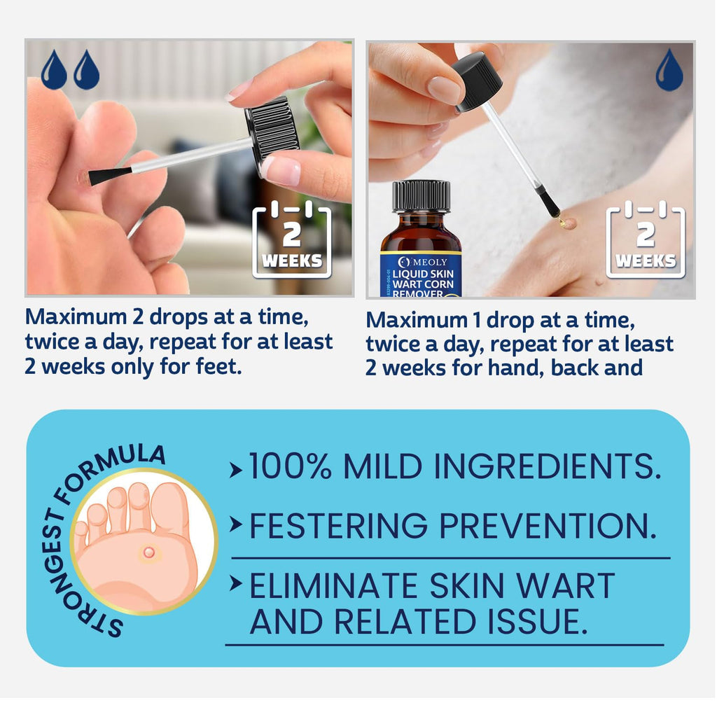 MEOLY Fast-Acting Wart Remover – 40% Salicylic Acid for Plantar Warts & Corns