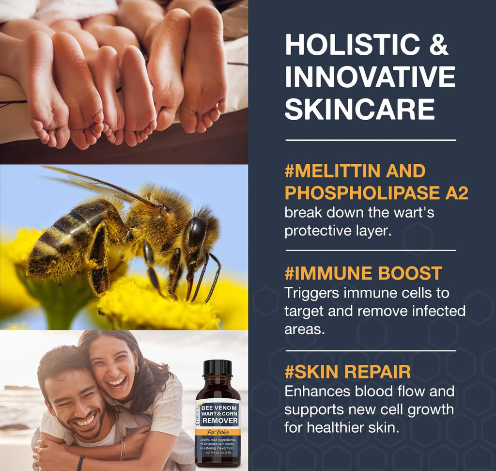 MEOLY Bee Venom Wart Remover – Fast-Acting 20% Salicylic Acid for Plantar and Genital Warts | Targeted Wart Care