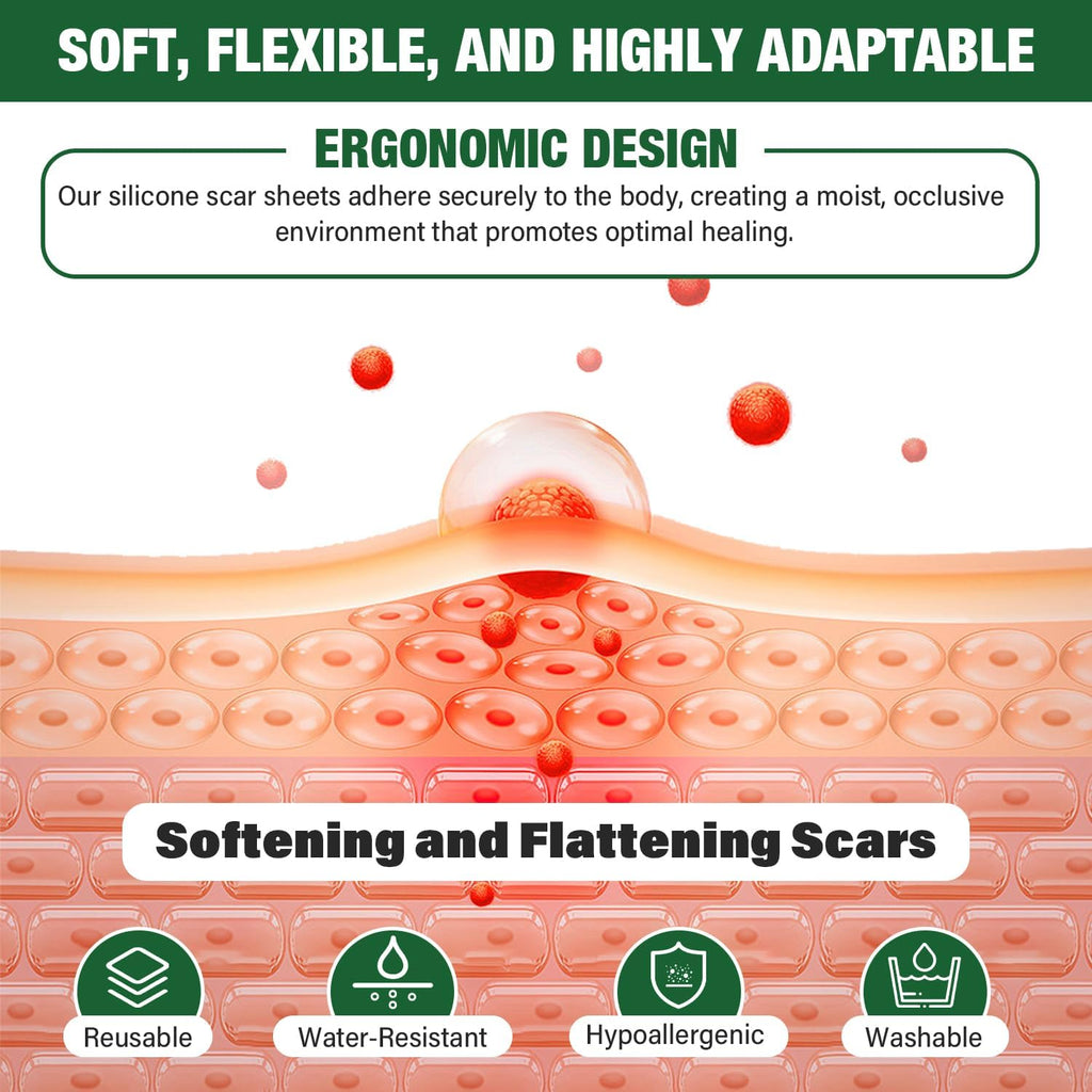Micakin Silicone Scar Sheets & Tape — 1.6x120 in Roll (3M)