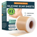 Micakin Silicone Scar Sheets & Tape — 1.6x120 in Roll (3M)